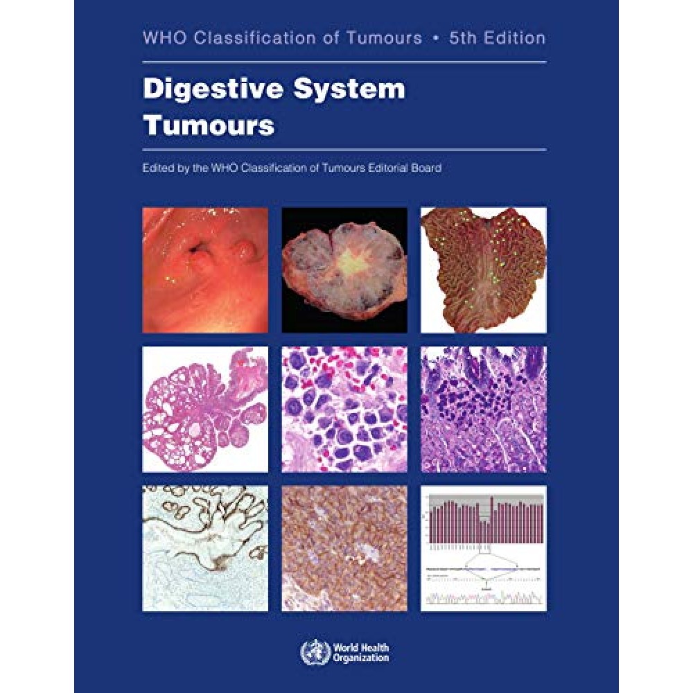 WHO Classification of Tumours: Digestive System Tumours 5th ed.