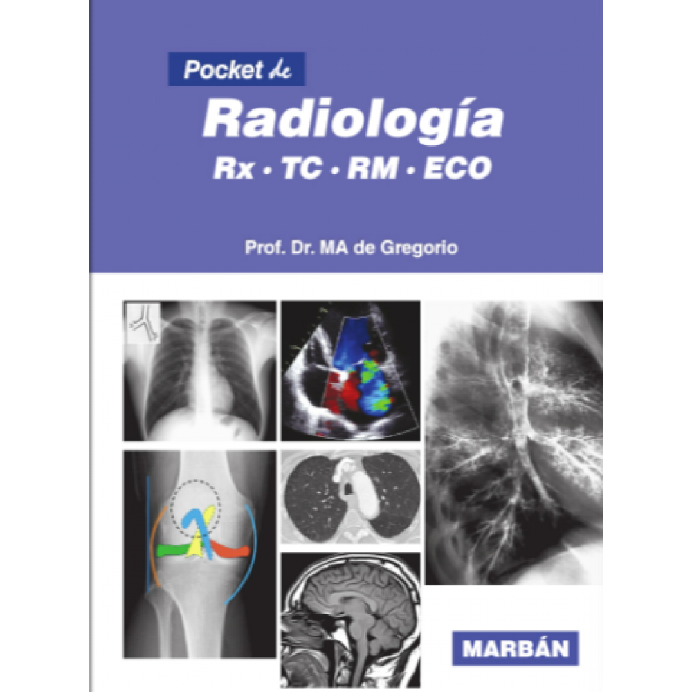 De Gregorio, Pocket de Radiologia 3a ed.