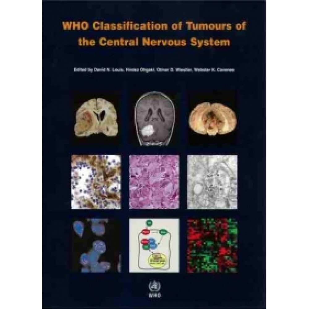 WHO Classification of Tumours of the Central Nervous System 4th ed. Vol 1