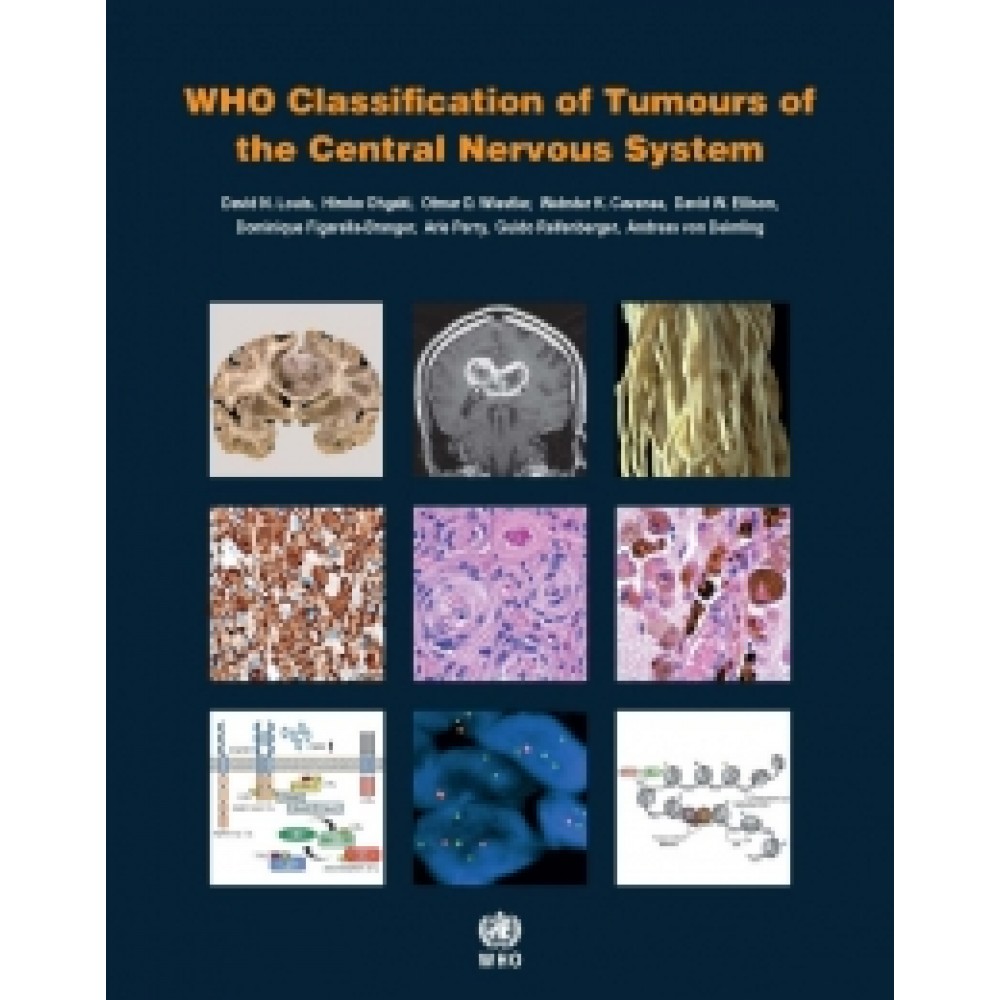 WHO Classification of Tumours of the Central Nervous System Revised 4th Edition, Volume 1