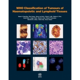 WHO Classification of Tumours of Haematopoietic and Lymphoid Tissues Revised 4th Edition, Volume 2