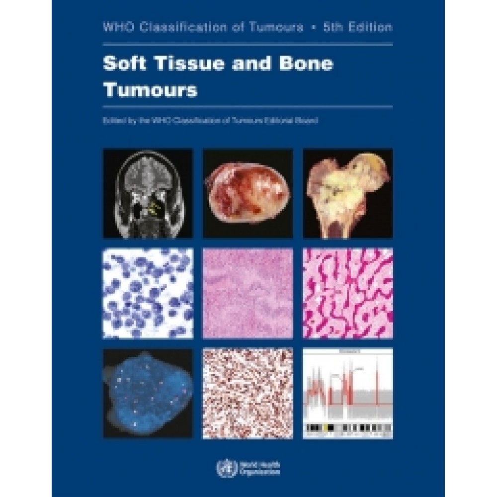WHO Classification of Tumours: Soft Tissue and Bone Tumours, 5th Edition, Volume 3