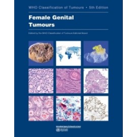 WHO Classification of Tumours: Female Tumours 5th ed. Vol 4