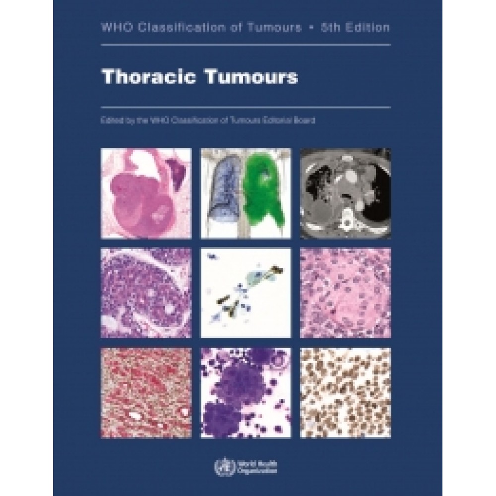 WHO Classification of Tumours: Thoracic Tumours 5th ed.
