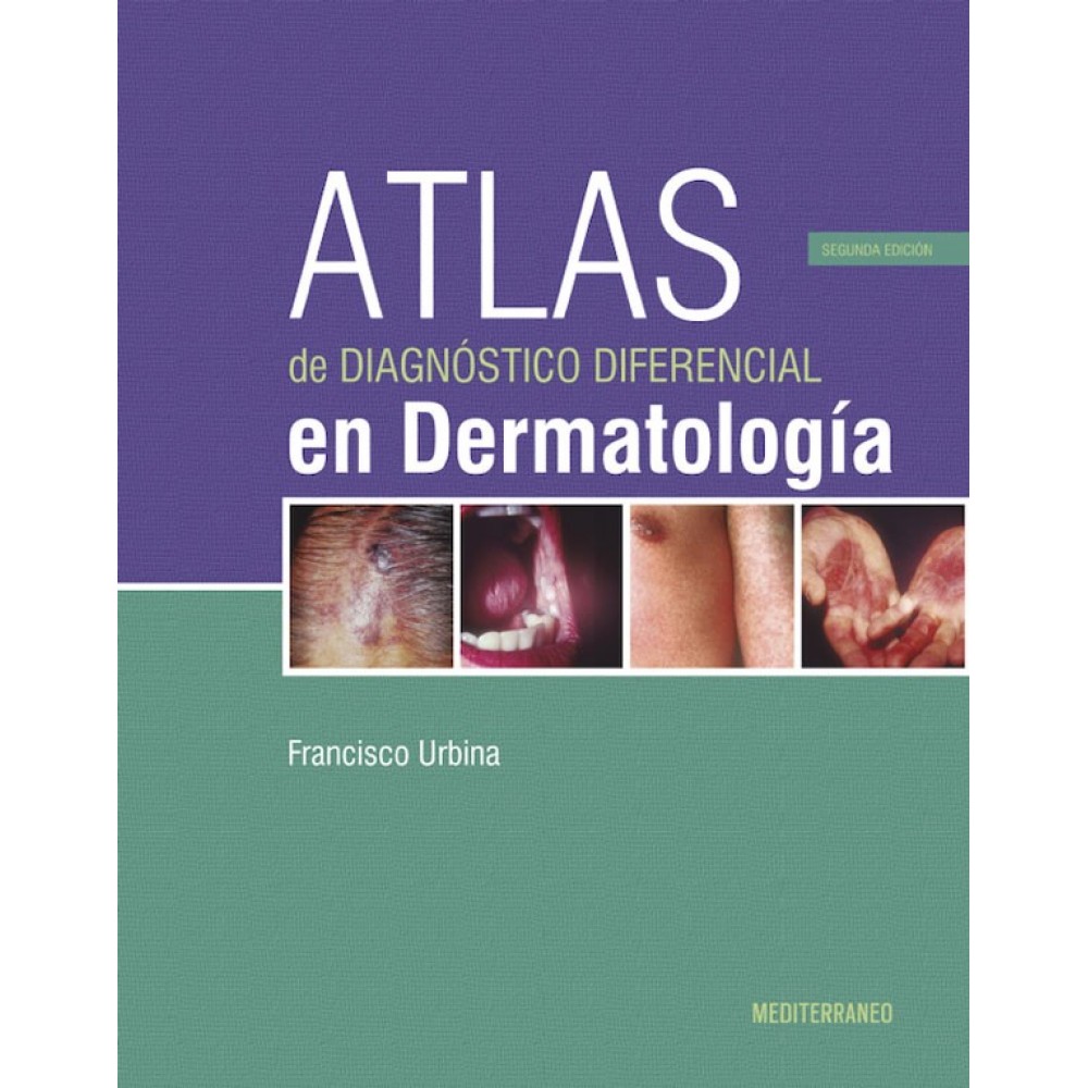 Urbina, Atlas de Diagnostico Diferencial en Dermatologia