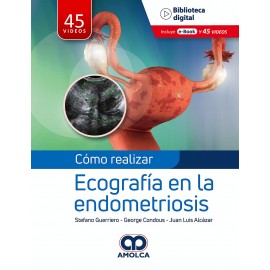 Como realizar Ecografia en la endometriosis - Stefano Guerriero
