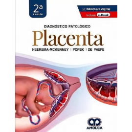 Diagnostico patologico: Placenta. 2a Edicion Heerema-McKenney, Edwina Popek y Monique DePaepe