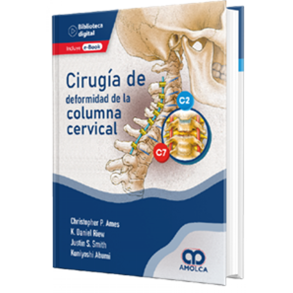 Cirugia de deformidad de la Columna Cervical - Ames