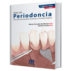Atlas de periodoncia. Tecnicas minimamente invasivas y microquirurgicas - Marcio Fernando De Moraes Grisi
