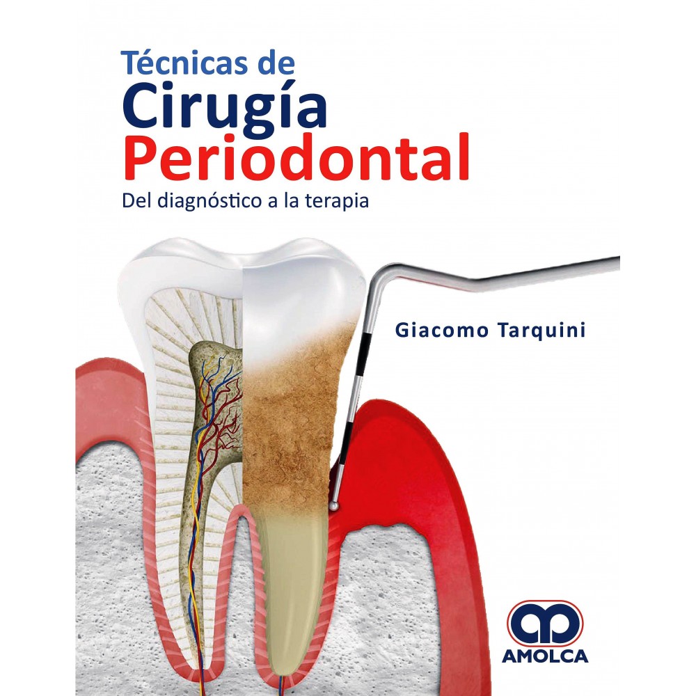 Tarquini, Técnicas de cirugía periodontal. Del diagnóstico a la terapia