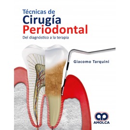 Tarquini, Técnicas de cirugía periodontal. Del diagnóstico a la terapia