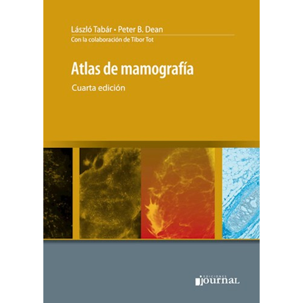 Atlas de Mamografia 4ª ed, Lazlo Tabar