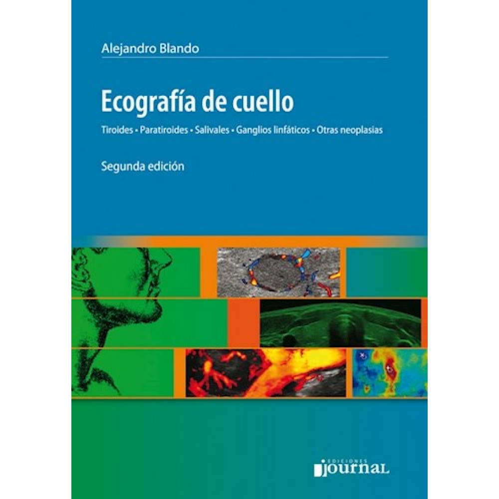 Ecografía de cuello, Tiroides, Paratiroides, Salivales, Ganglios linfáticos, Otras neoplasias 2ª ed. - Blando
