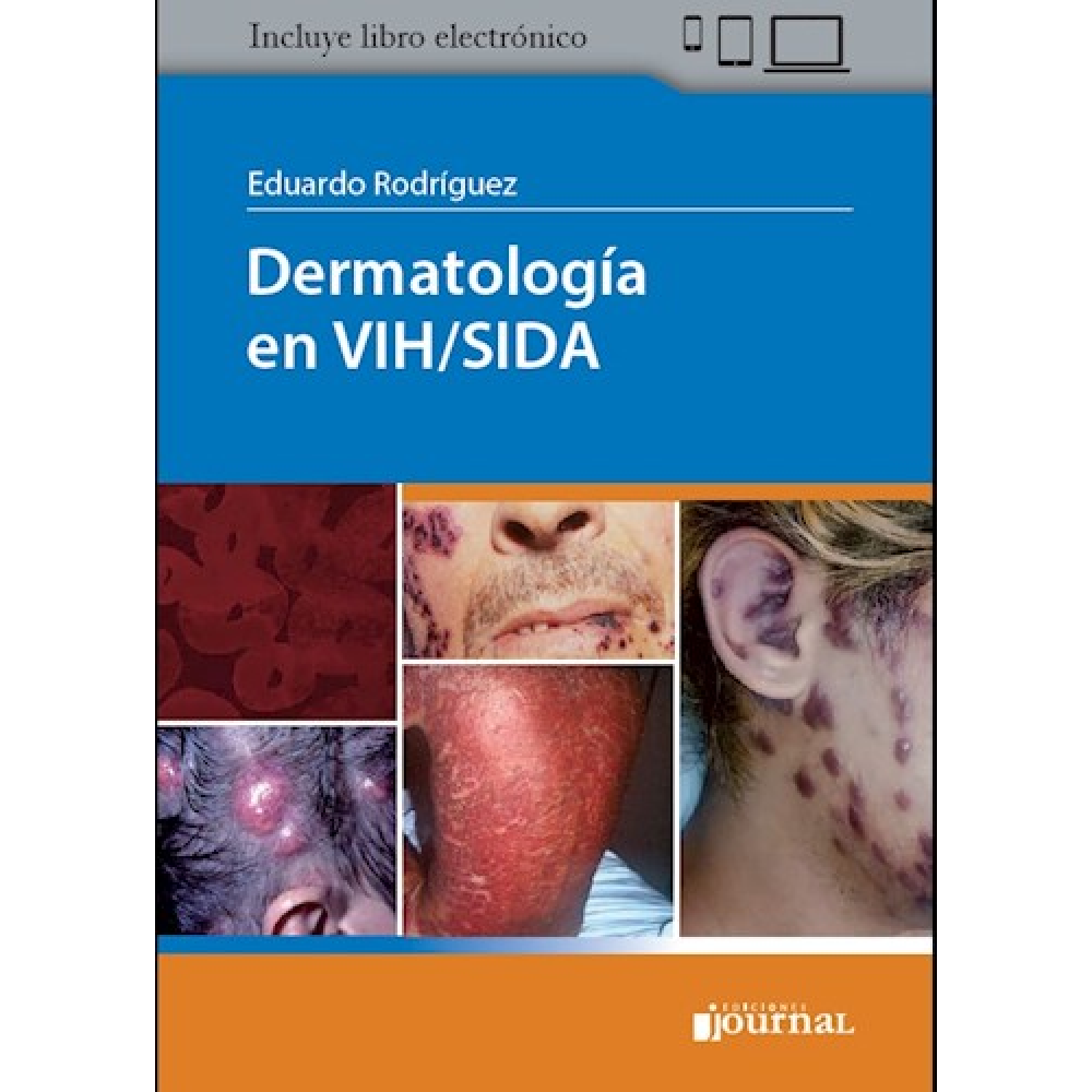 Dermatologia en VIH/SIDA - Rodriguez