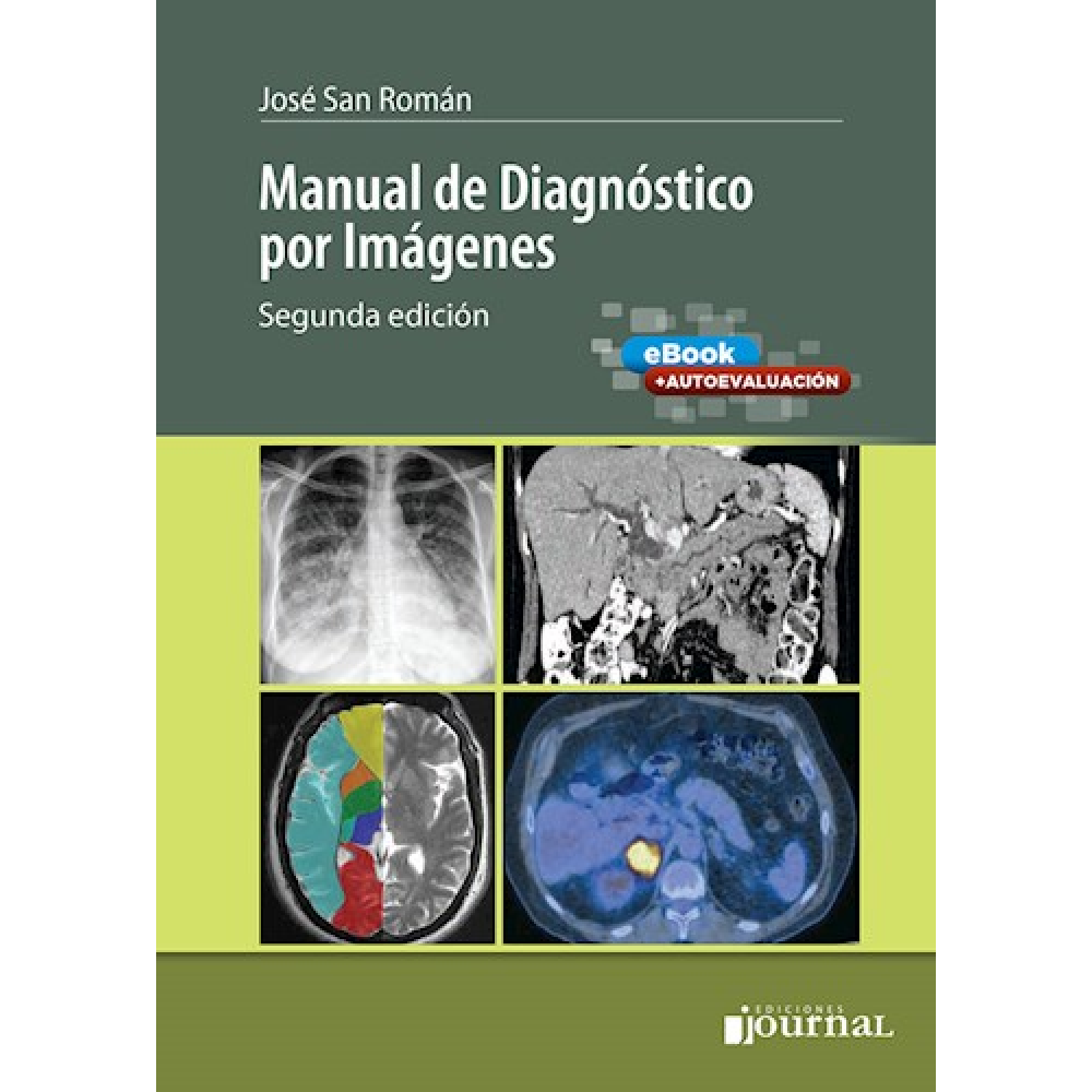 Manual de Diagnostico por Imagenes 2ª ed. - San Roman