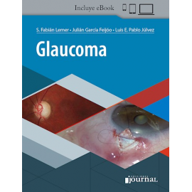 Lerner - Glaucoma incluye e-book