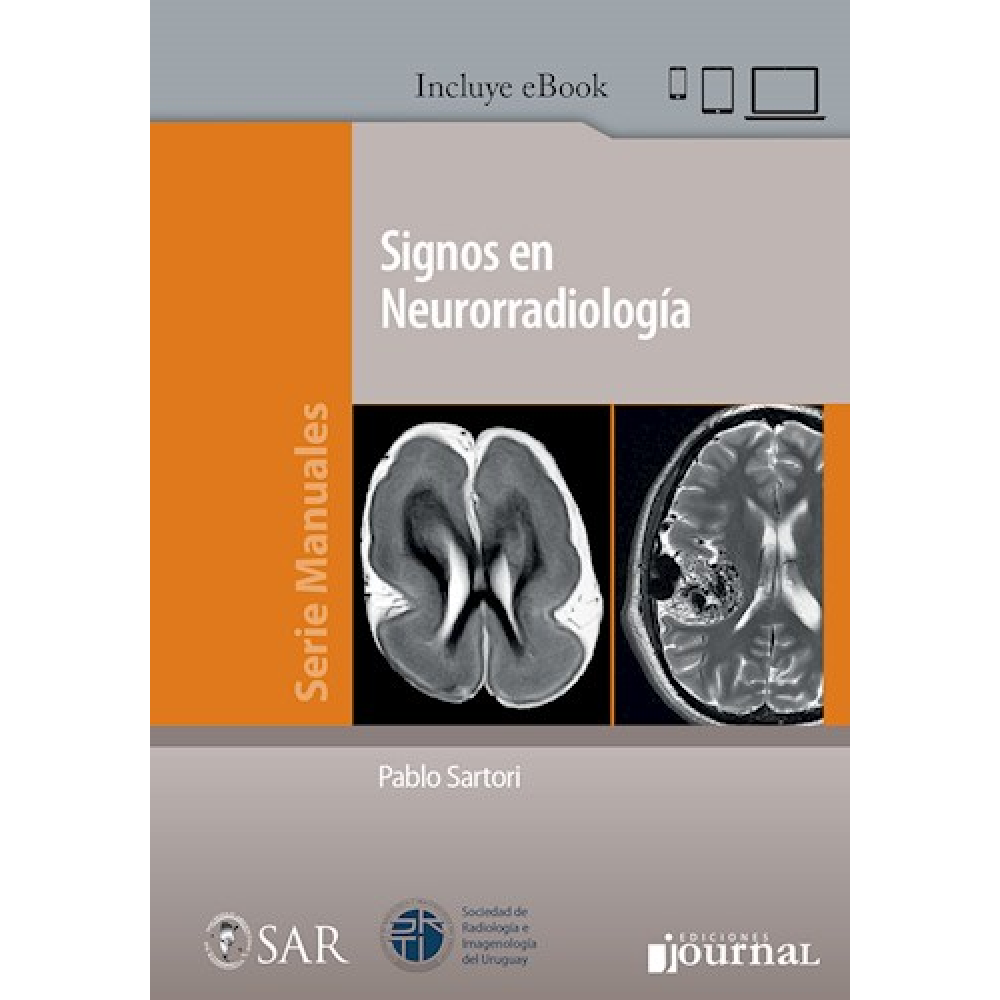 Signos en neuroradiologia - Sartori