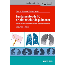 Webb Fundamentos de TC de alta resolución pulmonar - 2ª Ed.