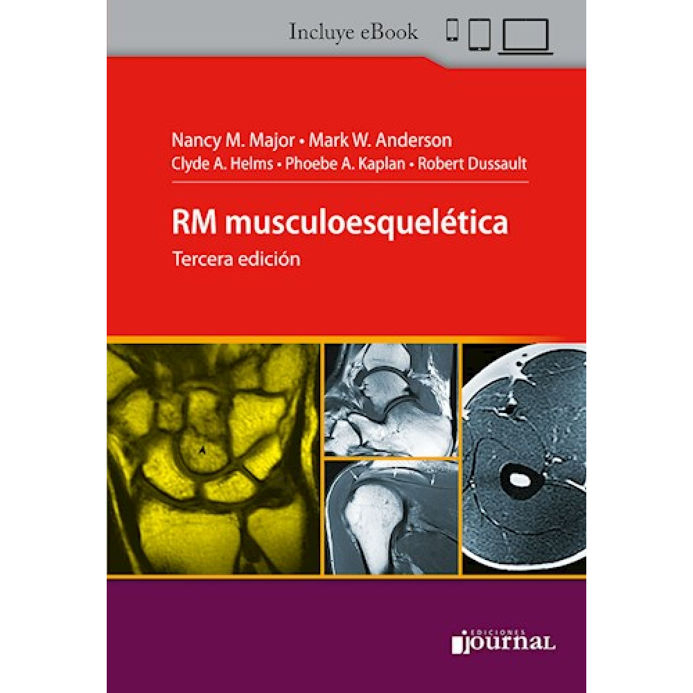 RM musculoesqueletica 3ª ed. Major , Helms ,  Kaplan