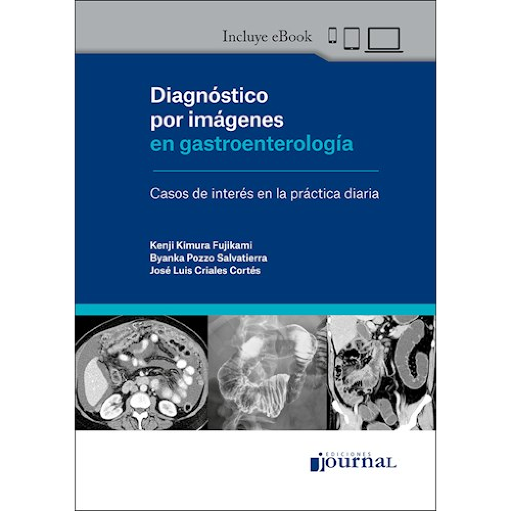 Diagnostico por imagenes en gastroenterologia Casos de interes en la practica diaria + eBook - Kimura