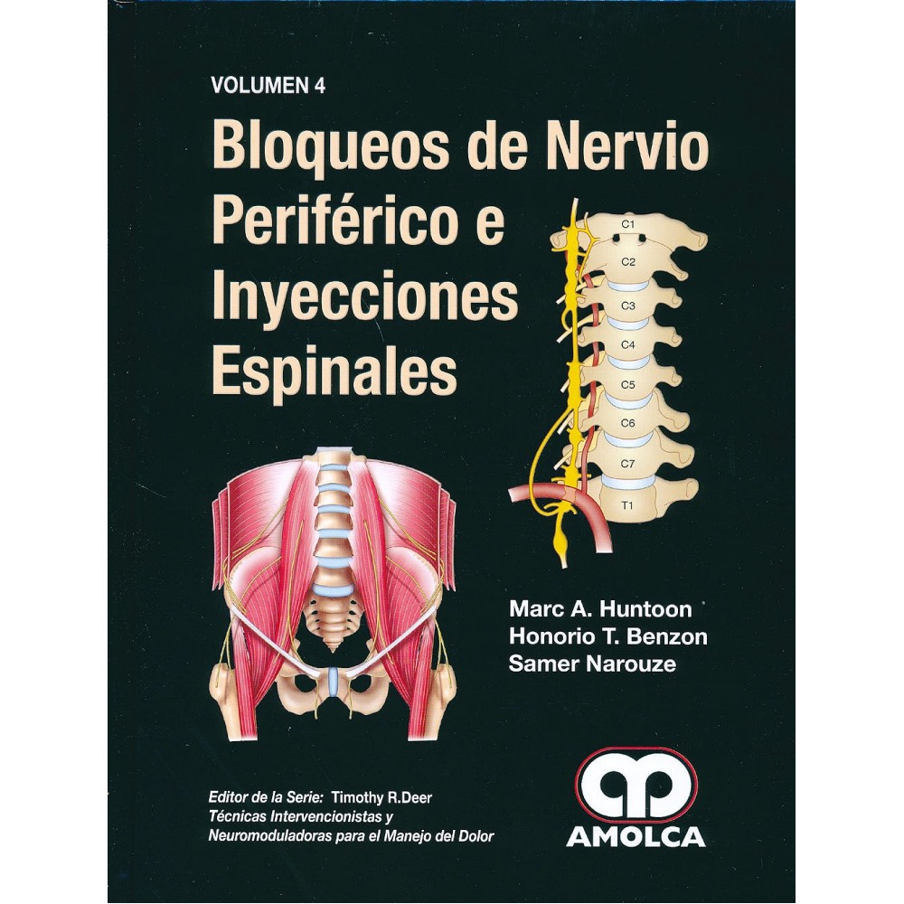 Huntoon, Bloqueos de Nervio Periferico e Inyecciones Espinales