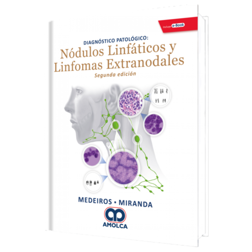 Diagnostico Patologico Nodulos Linfaticos y Linfomas Extranodales - L. Jeffrey Medeiros