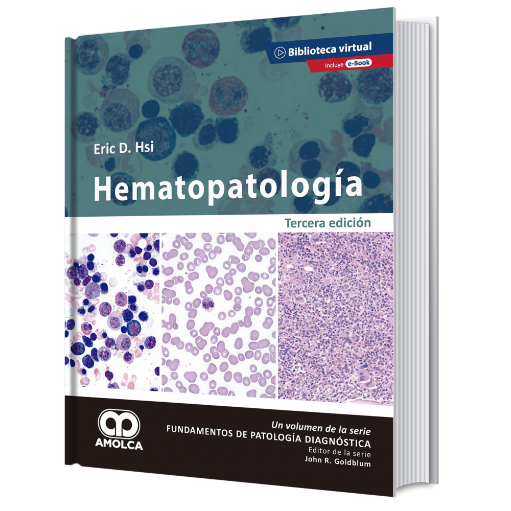 Hematopatologia. Tercera edicion - Eric D. Hsi