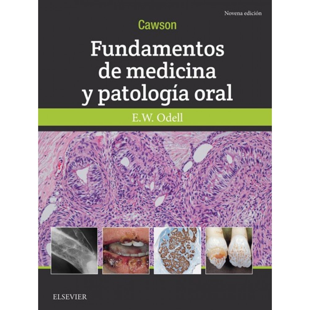 Cawson Fundamentos de Medicina y Patologia Oral 9ª ed.