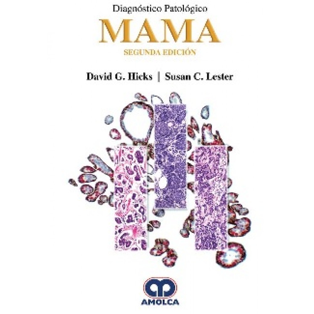 Hicks, Diagnostico Patologico: MAMA  Segunda edicion Edicion: 2018