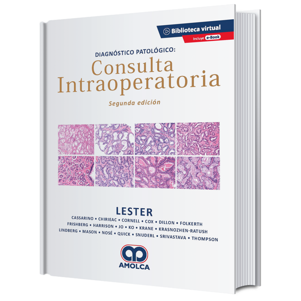 Lester Diagnostico patologico: consulta intraoperatoria 2ª ed.