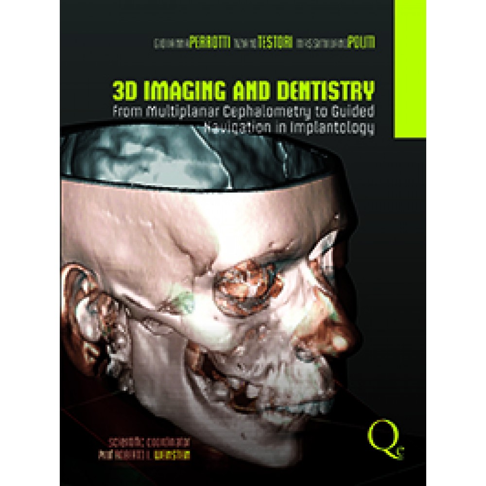 3D Imaging and Dentistry: From Multiplane Cephalometry to Guided Navigation in Implantology - Perrotti
