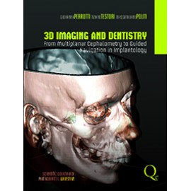 3D Imaging and Dentistry: From Multiplane Cephalometry to Guided Navigation in Implantology - Perrotti