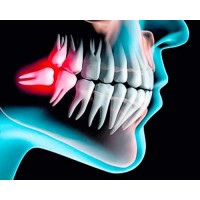 Cirugia oral y maxilofacial