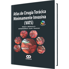 McKenna, Atlas de Cirugia Toracica Minimamente Invasiva (VATS)