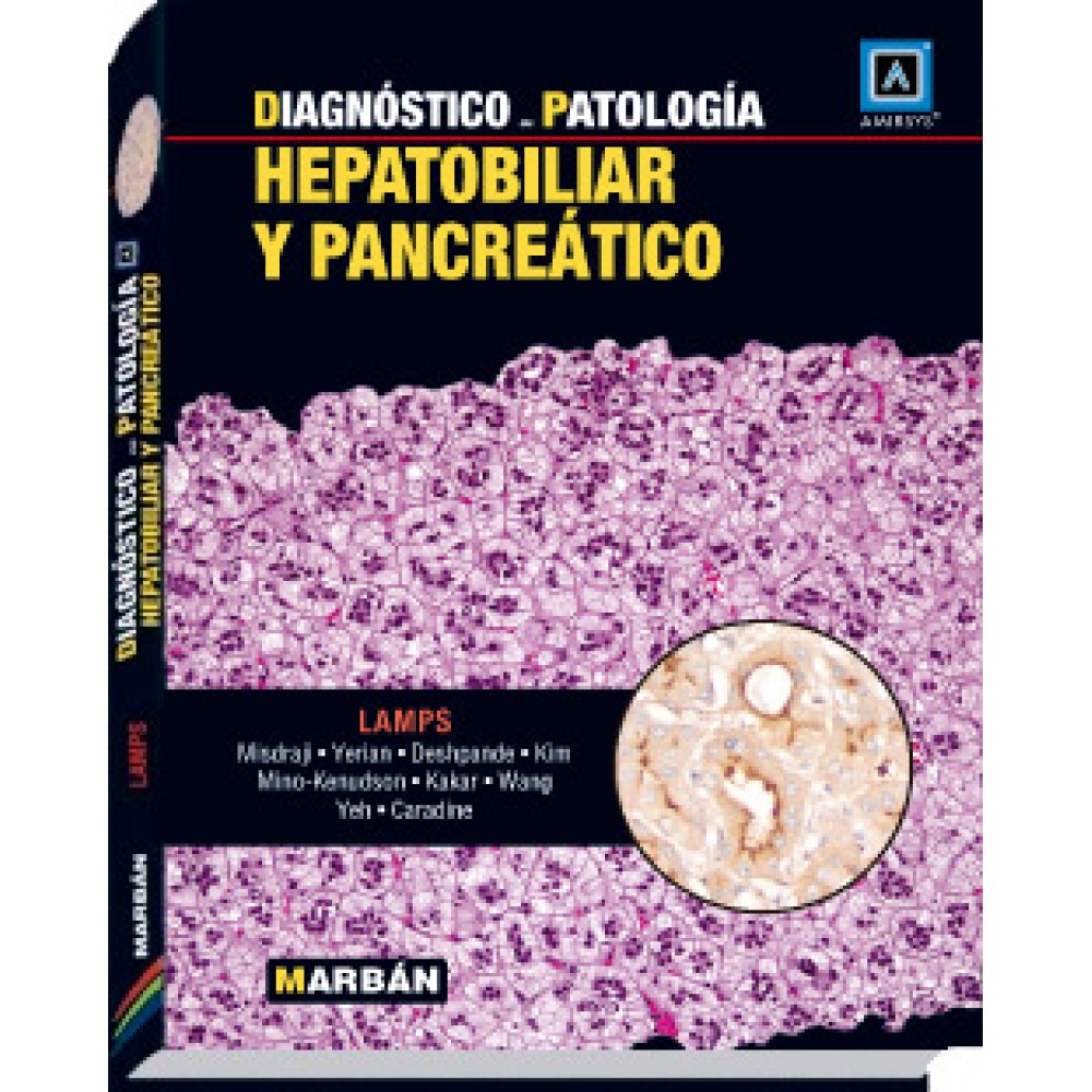 Lamps, Diagnostico en Patologia: Hepatobiliar y Pancreatico