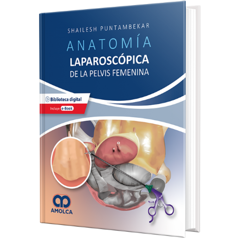 PUNTAMBEKAR, Anatomia Laparoscopica de la Pelvis Femenina. Principios quirúrgicos aplicados
