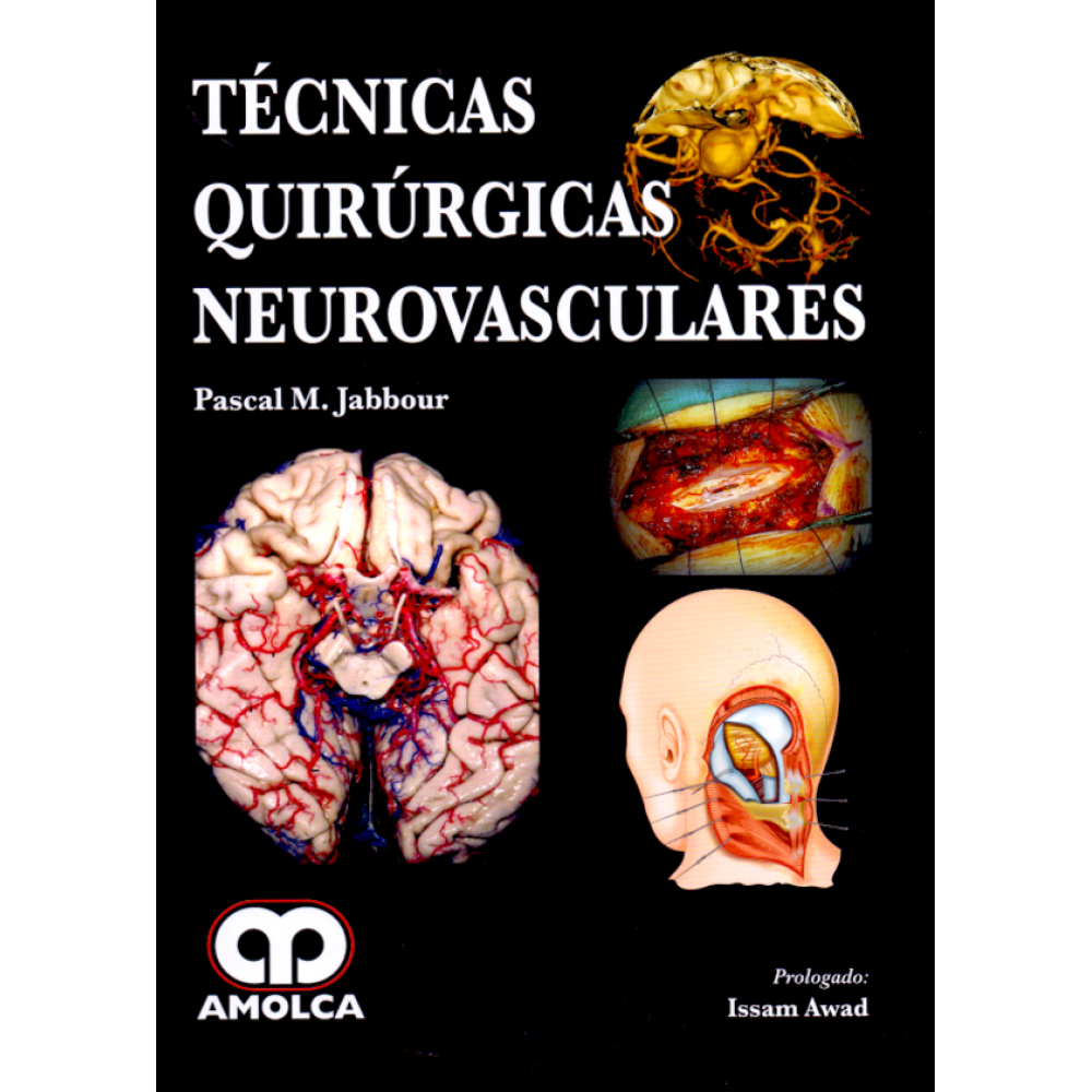 Jabbour, Tecnicas Quirurgicas Neurovasculares