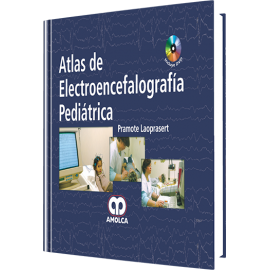 Laoprasert, Atlas de Electroencefalografia Pediatrica