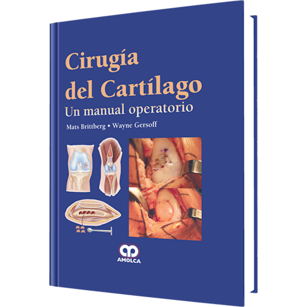 Brittberg, Cirugia del Cartilago. Un manual operatorio