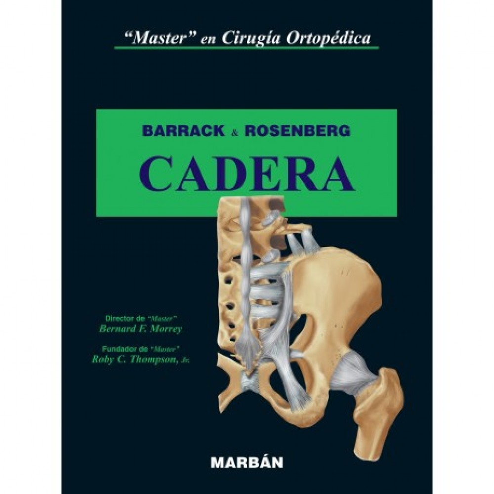 Barrack, Master en cirugia ortopedica Cadera. Tapa Rustica