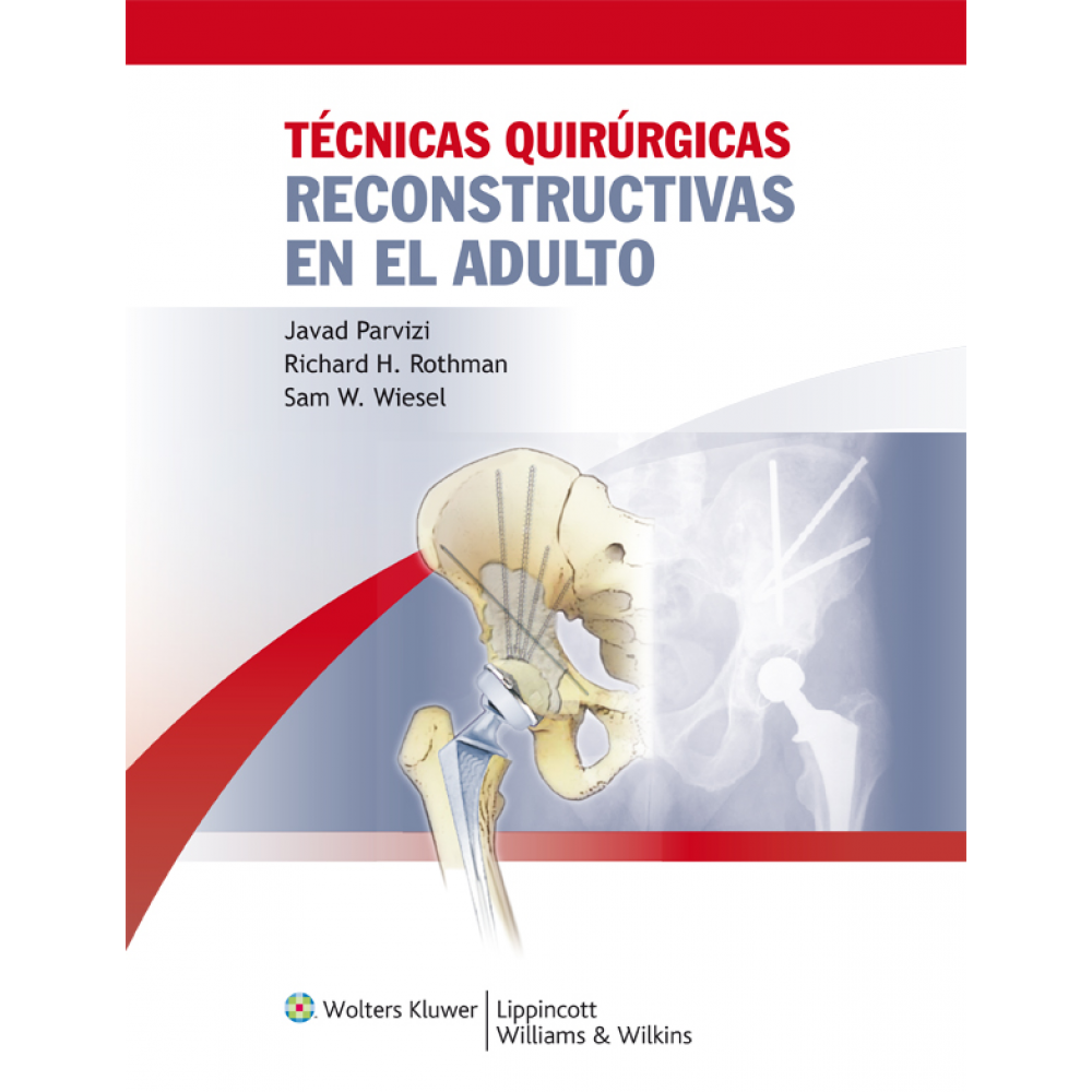 Parvizi y Rothman , Tecnicas quirurgicas reconstructivas en el adulto