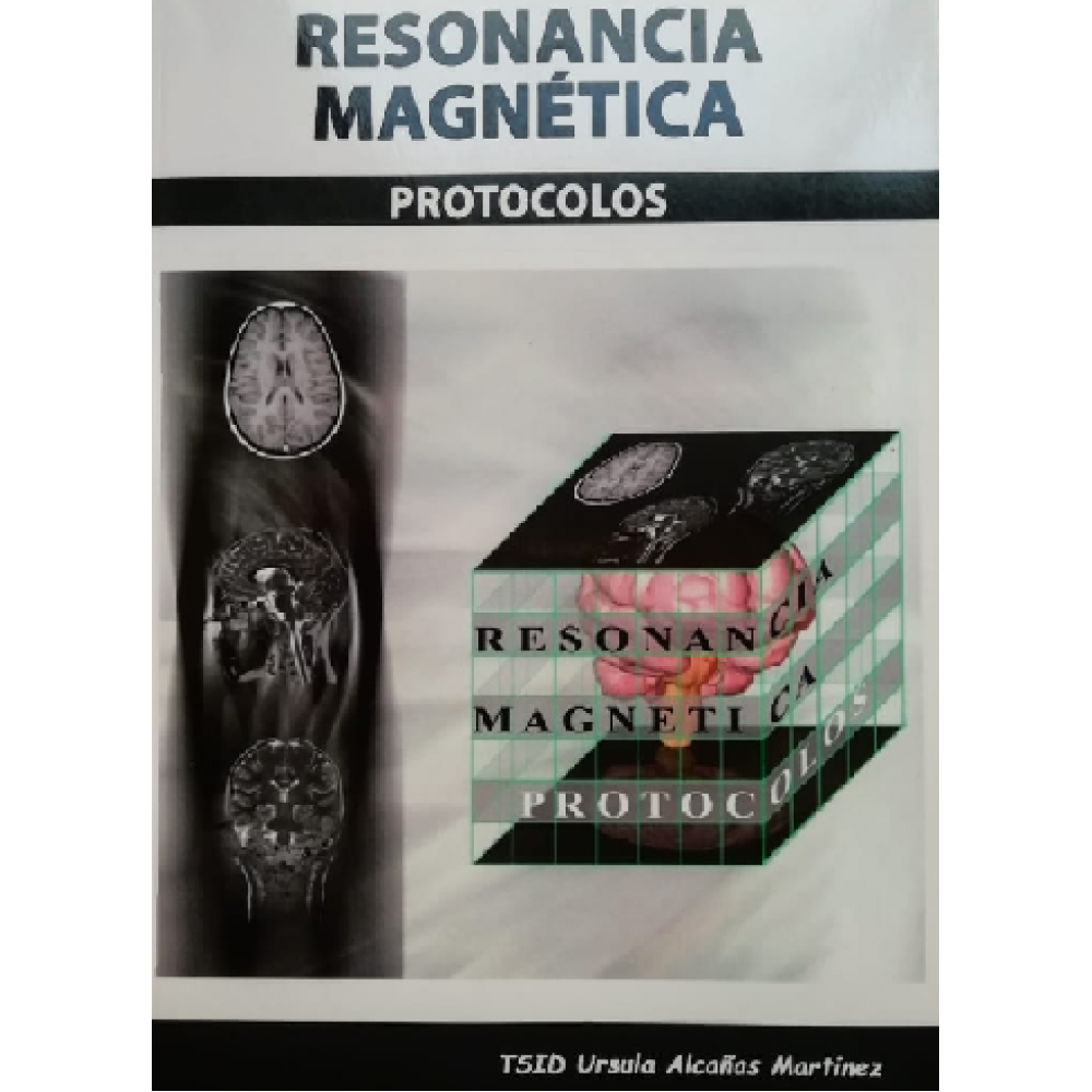 Alcañas. Protocolos en Resonancia Magnetica