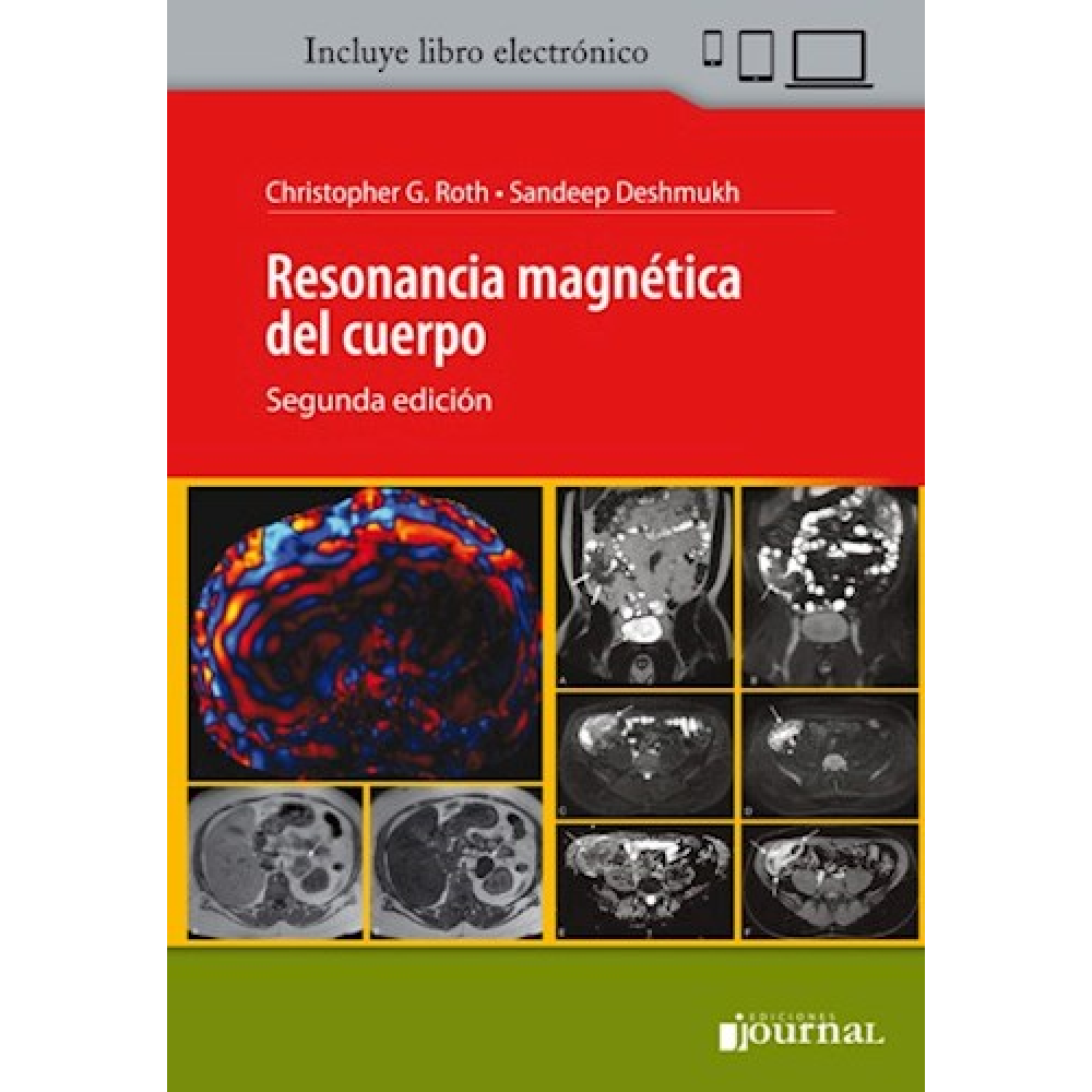 Roth, Resonancia Magnetica del Cuerpo 2ª ed.