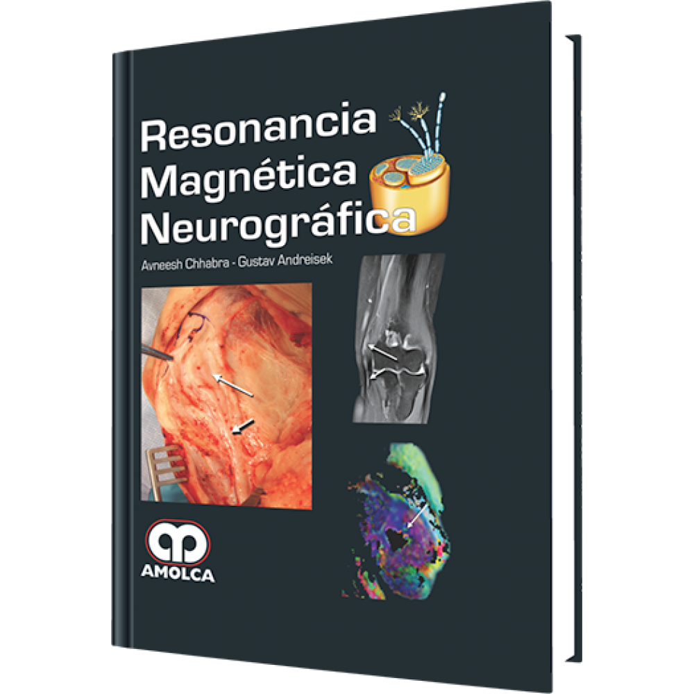 Chhabra, Resonancia Magnetica Neurografica
