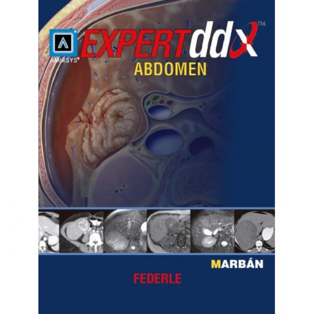 Federle, Expert DDX Abdomen