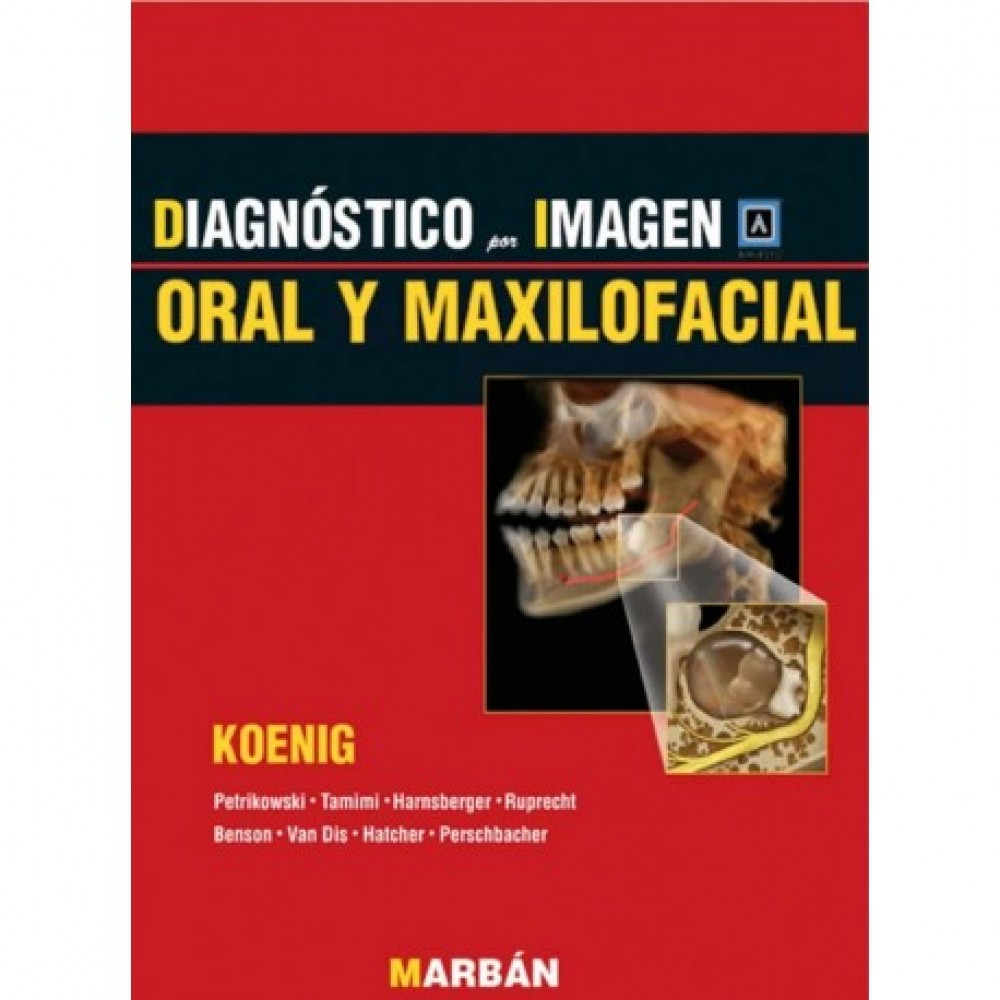 Koenig, Diagnostico por Imagen Oral y Maxilofacial