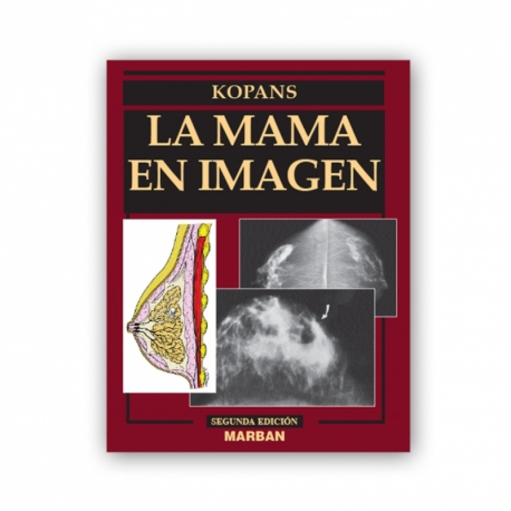 Kopans, La Mama en Imagen. 2a Ed.