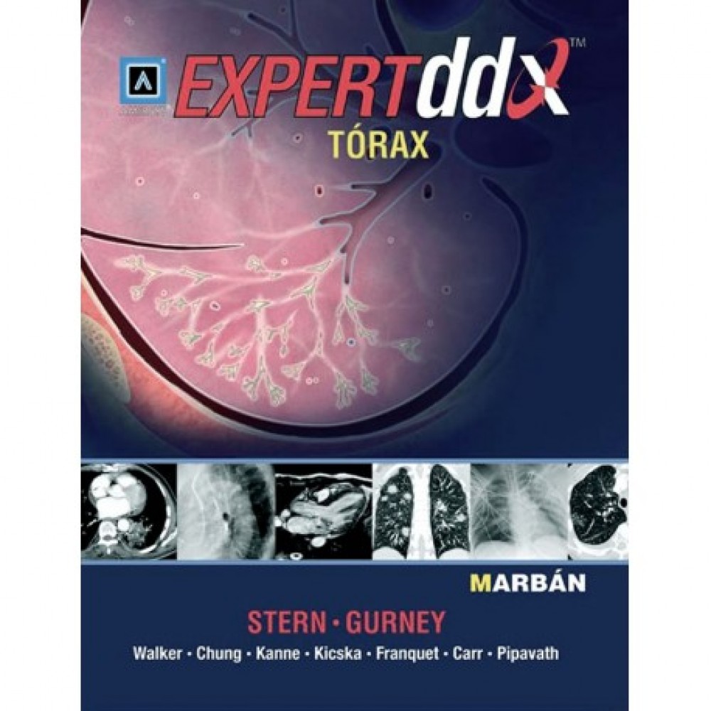Stern, Expert DDX Torax