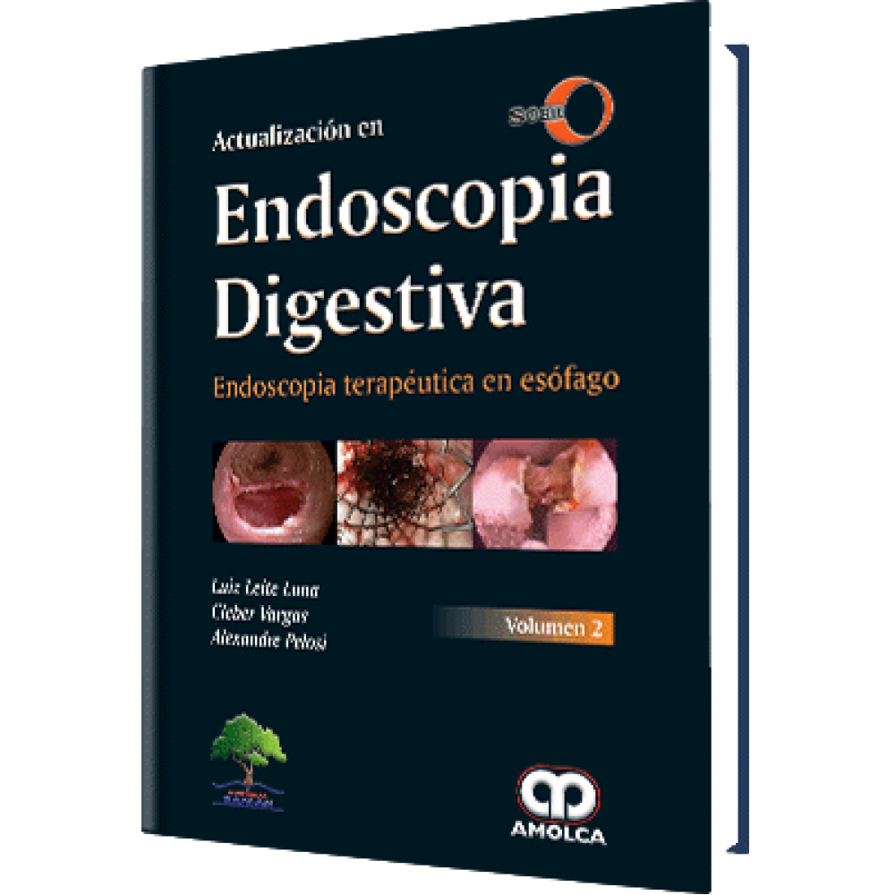 Leite - Actualizacion en Endoscopia Digestiva / Endoscopia terapeutica en esofago