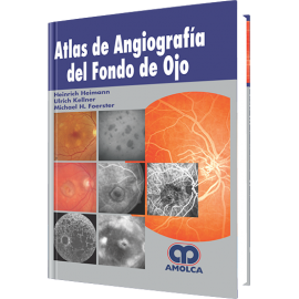 Heimann - Atlas de Angiografia del Fondo de Ojo